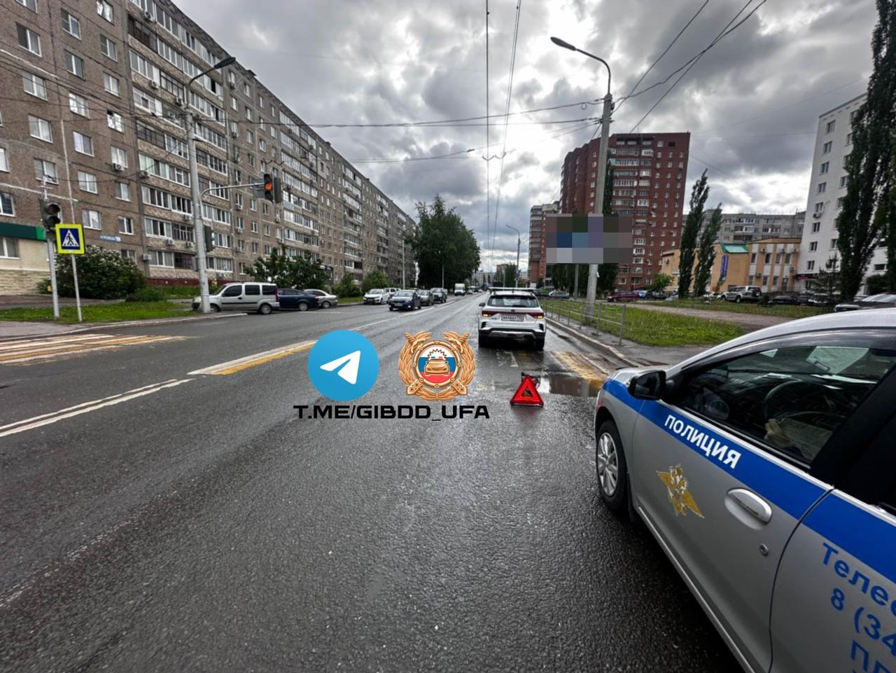 В Уфе пенсионерка госпитализирована после наезда легковушки