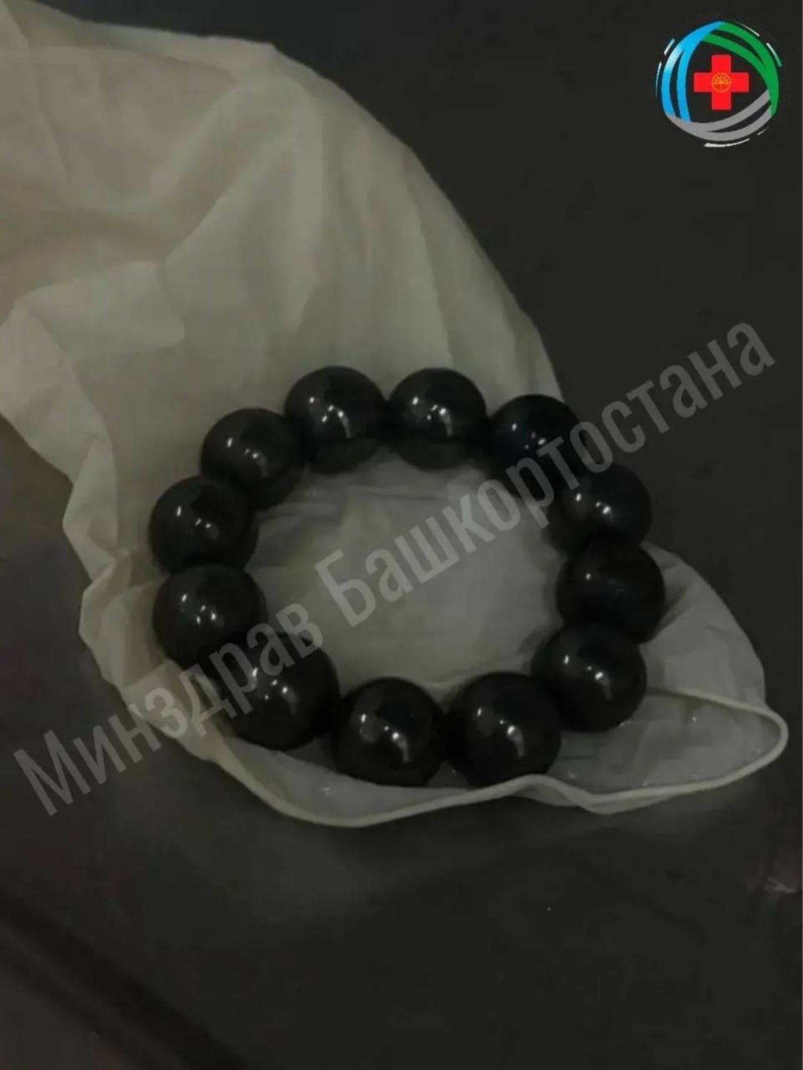 В Уфе врачи достали из пищевода девочки двенадцать магнитных шариков