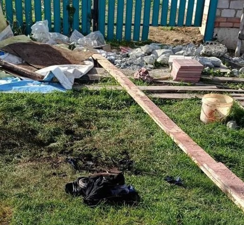 Житель Башкирии обгорел в гараже и едва живым попал в реанимацию